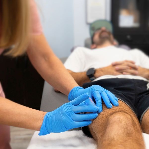 A patient getting acupuncture treatment by Dr. Debbie Murdock