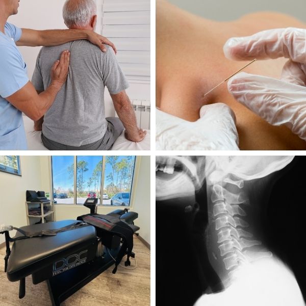 A collage of four pictures showing a man getting a chiropractic care from a doctor, acupuncture treatment, a spinal decompression table and x-rays