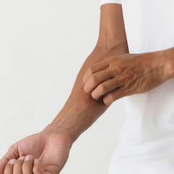 a man in a white shirt is scratching his arm rash