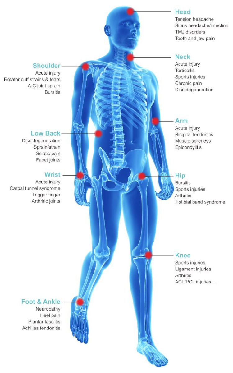 a diagram showing the treatable pain with laser therapy