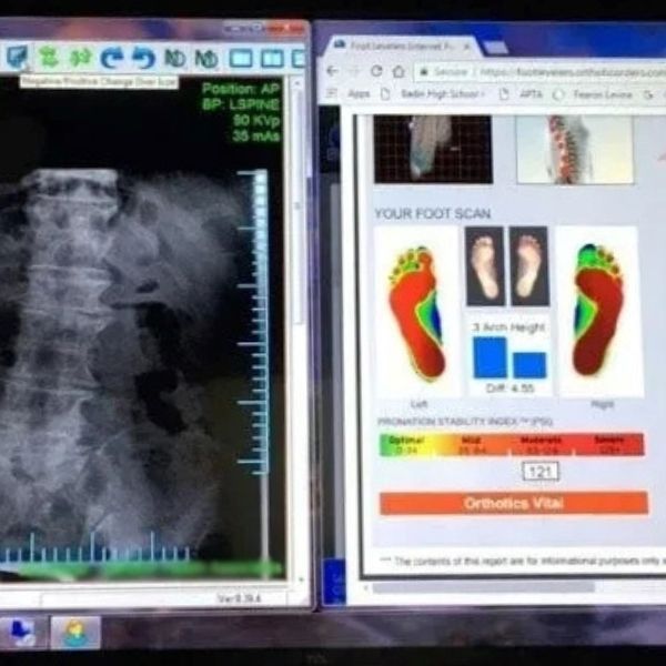 a computer screen shows a foot scan and an x-ray of a person 's foot for custom orthotics