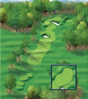 Aerial view of a golf course hole with fairway, green, sand traps, and trees.