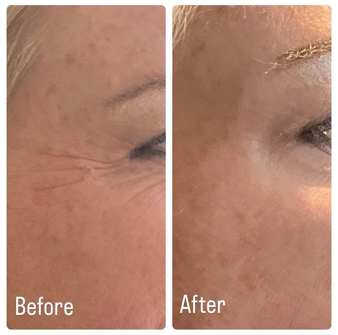 A before and after photo of a woman 's face