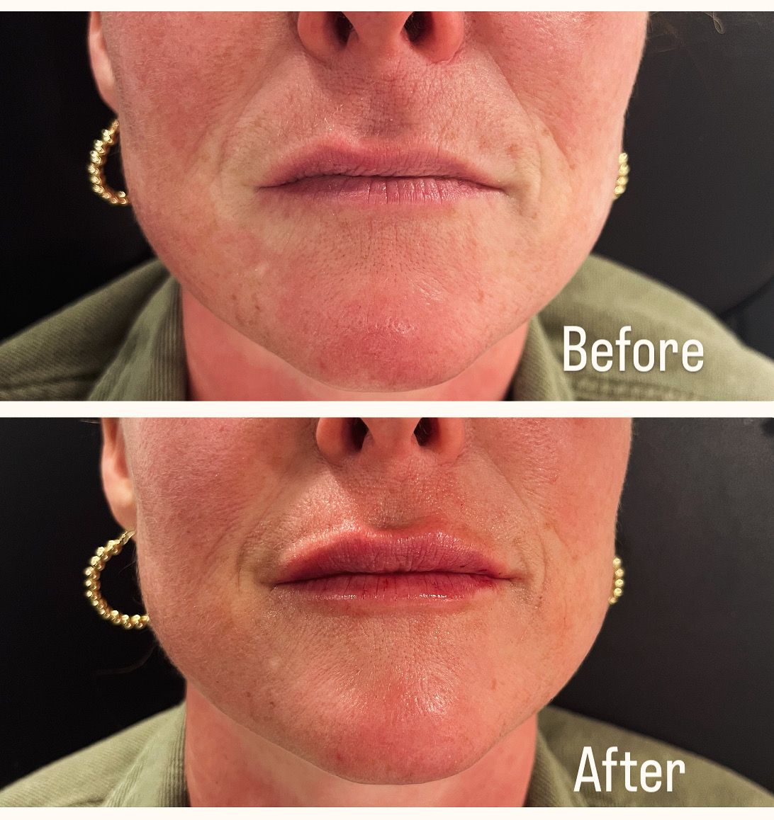 A before and after photo of a woman 's face