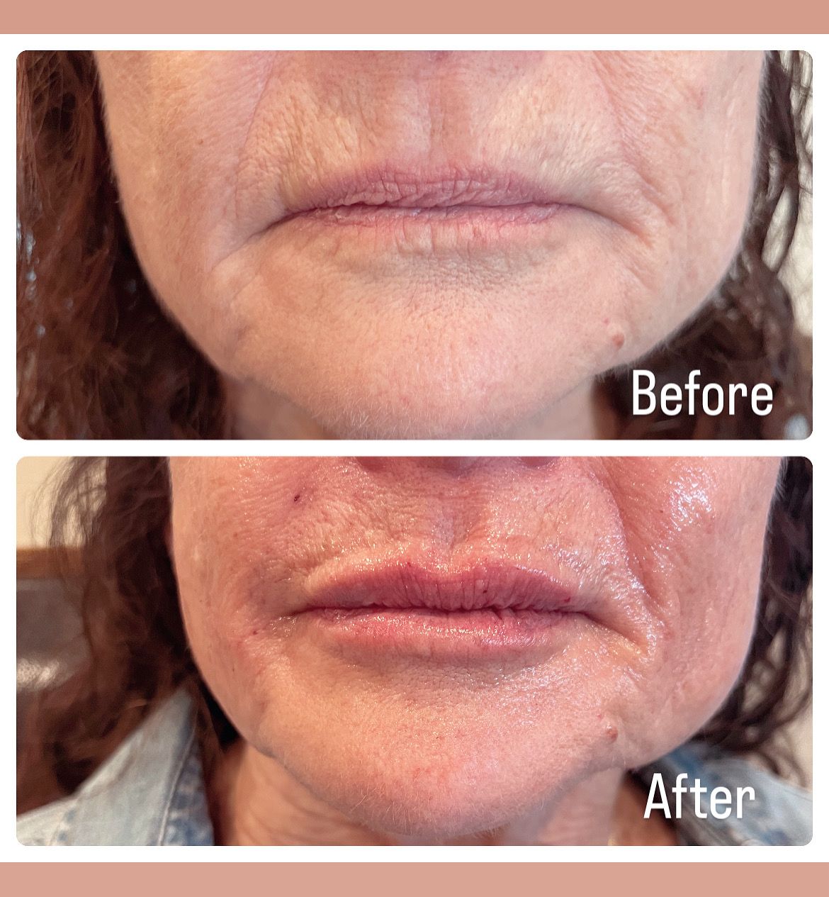 A before and after photo of a woman 's face.