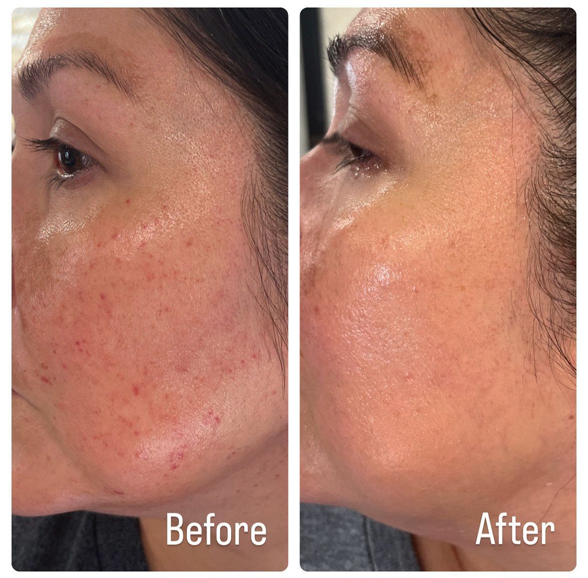 A before and after photo of a woman 's face