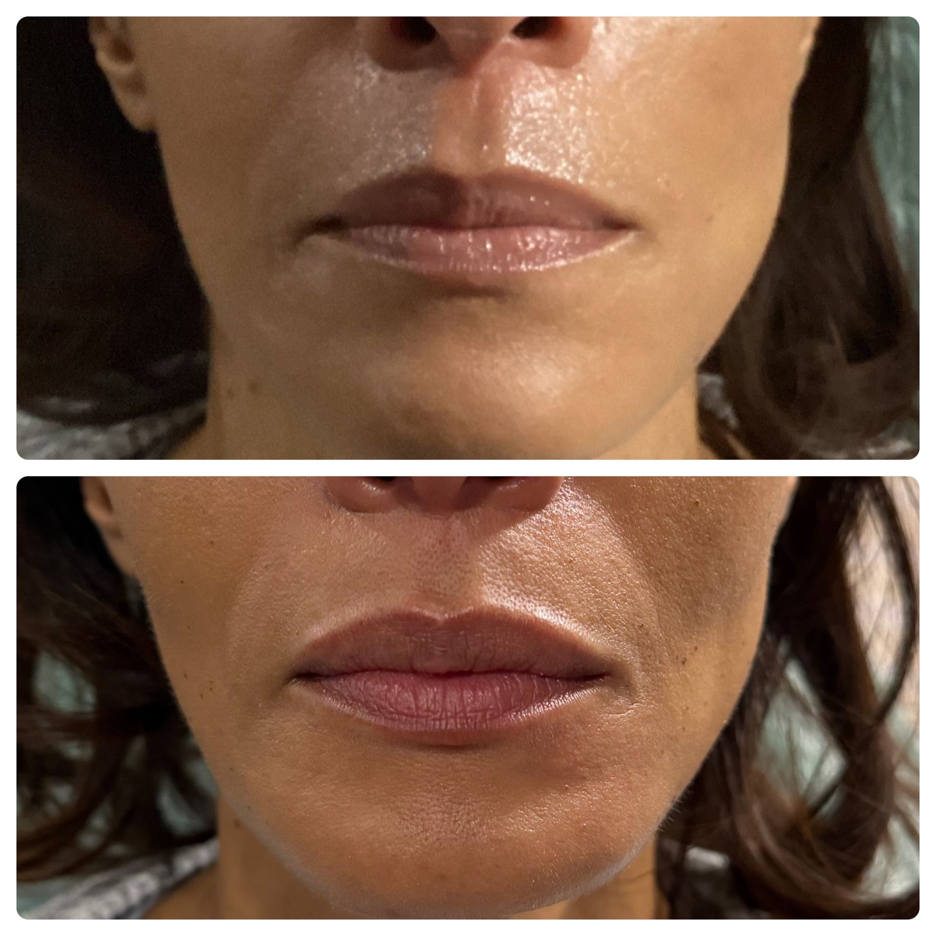 A before and after photo of a woman 's lips.