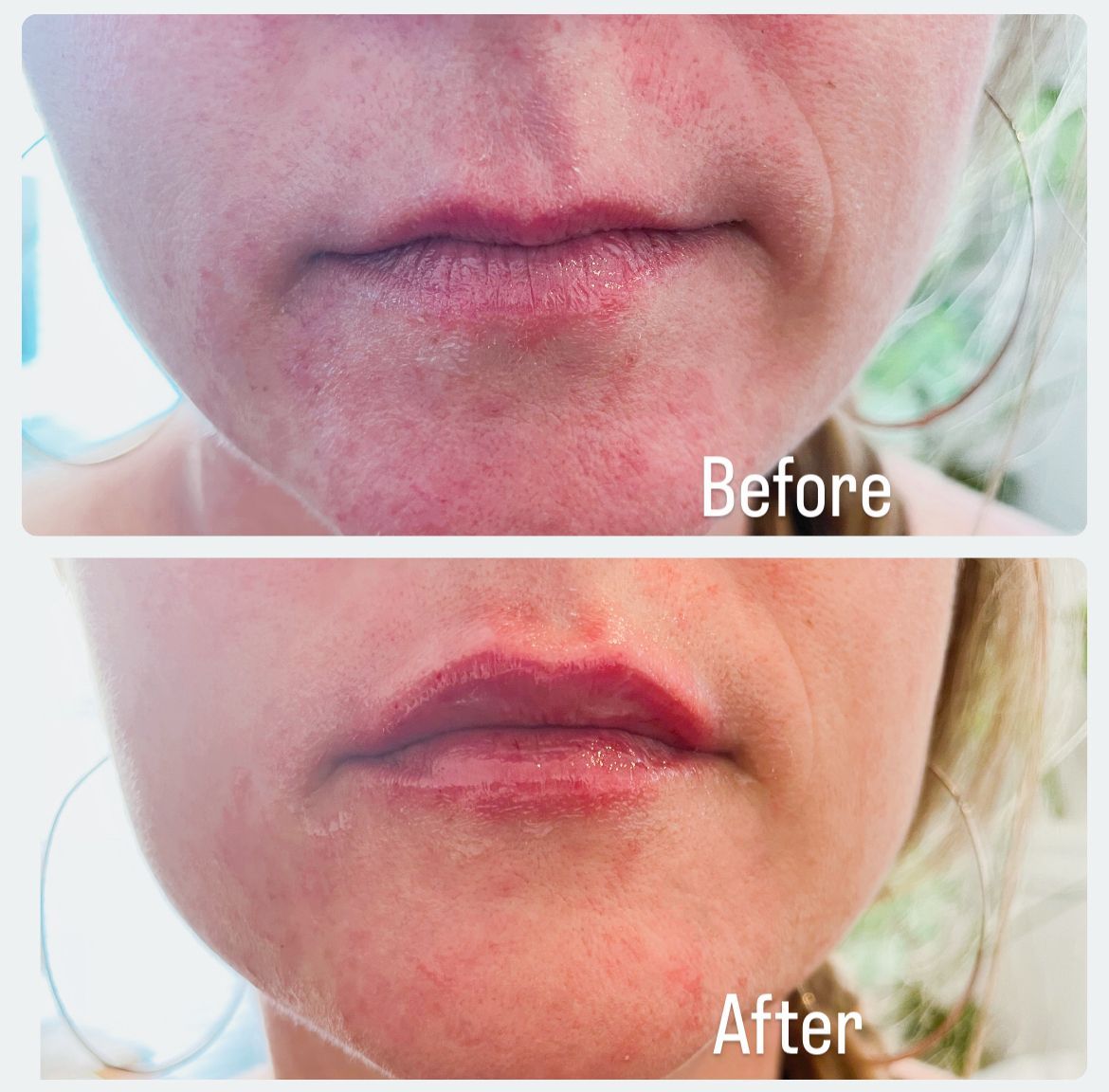 A before and after photo of a woman 's face