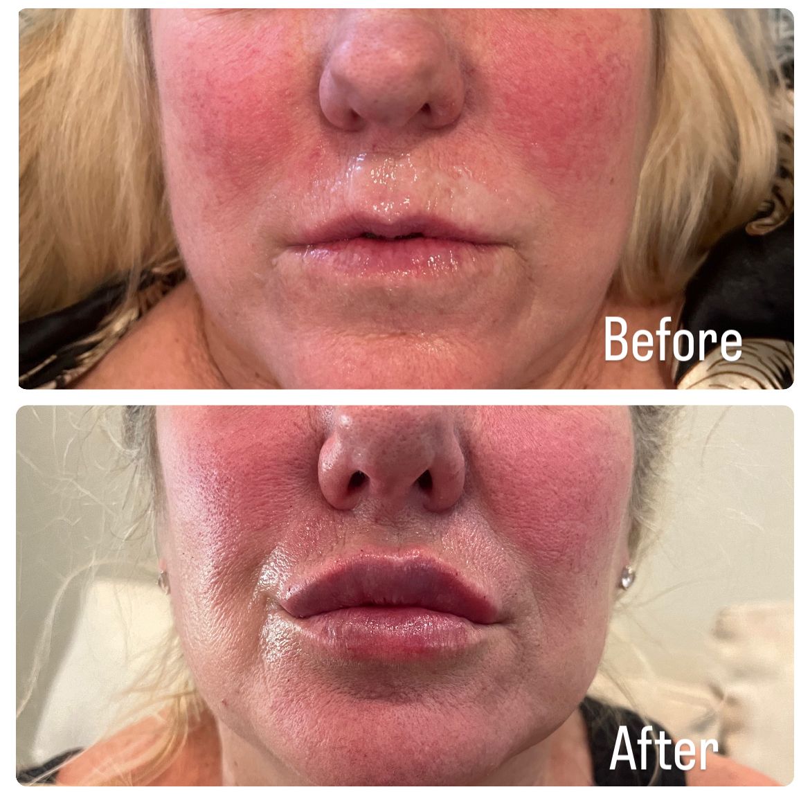 A before and after photo of a woman 's face