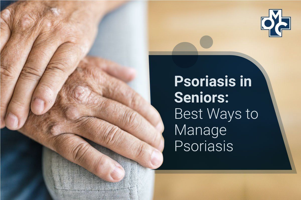 Psoriasis in Seniors: Best Ways to Manage Psoriasis