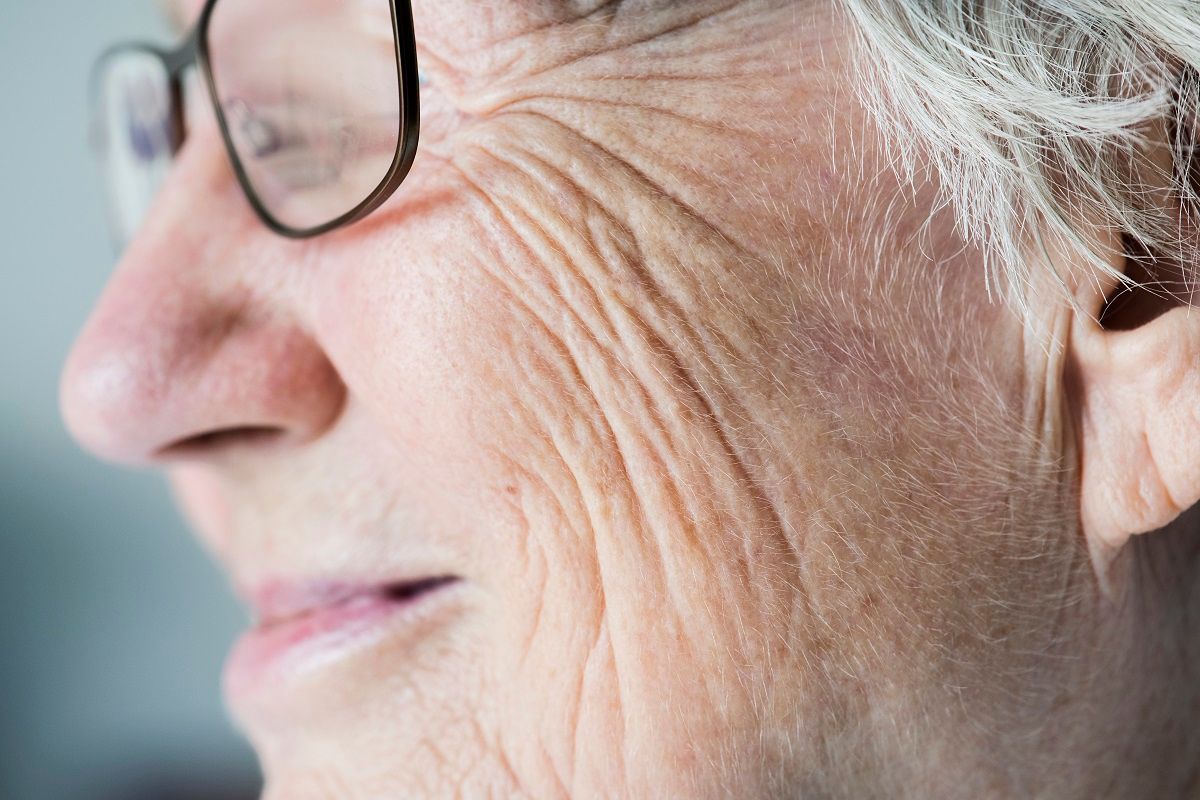 Common Skin Conditions in Seniors: What's Your Concern?