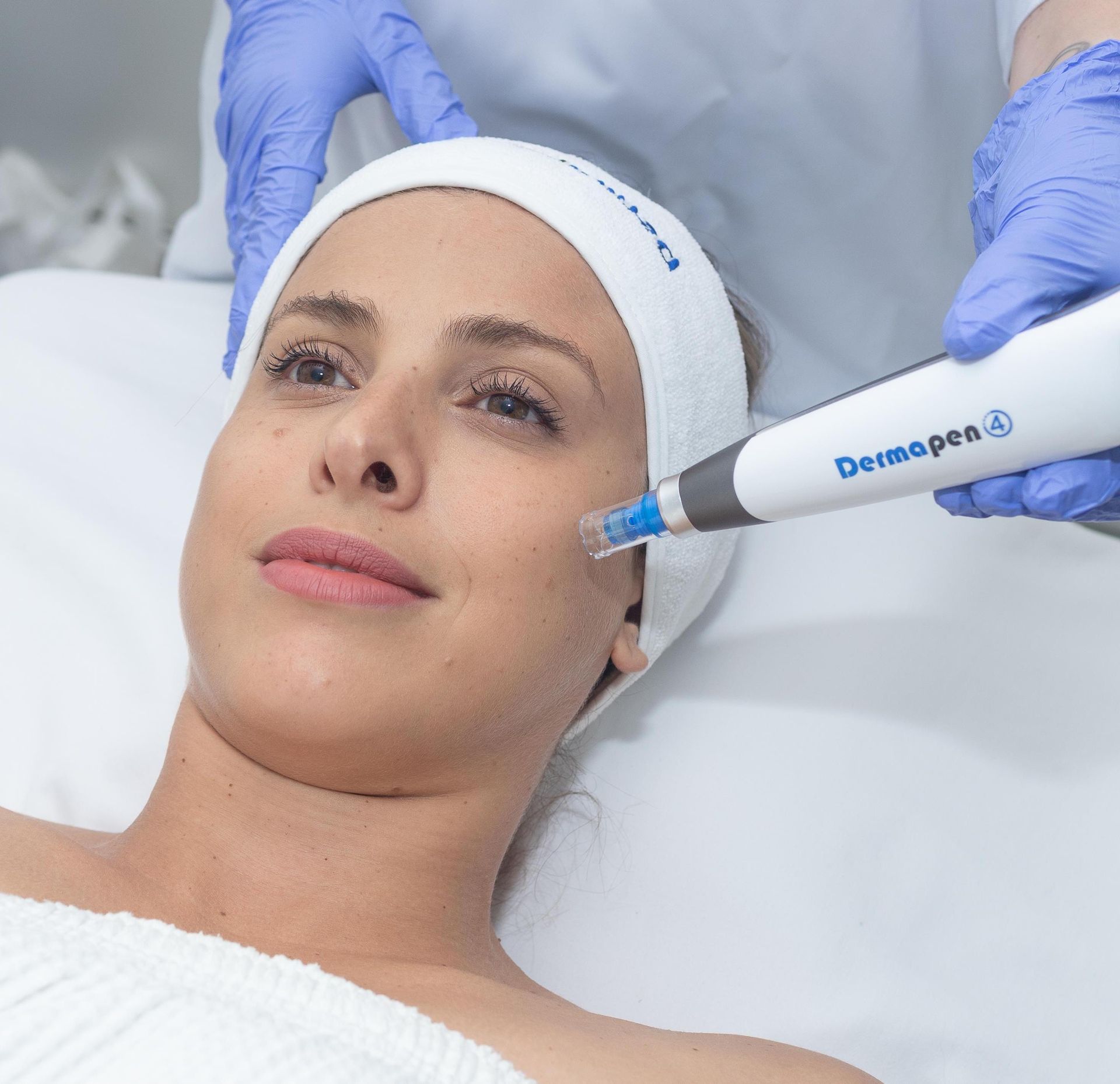 A Woman is Getting a Derma Pen Treatment on Her Face — Aura Mediclinic in Ashmore, QLD