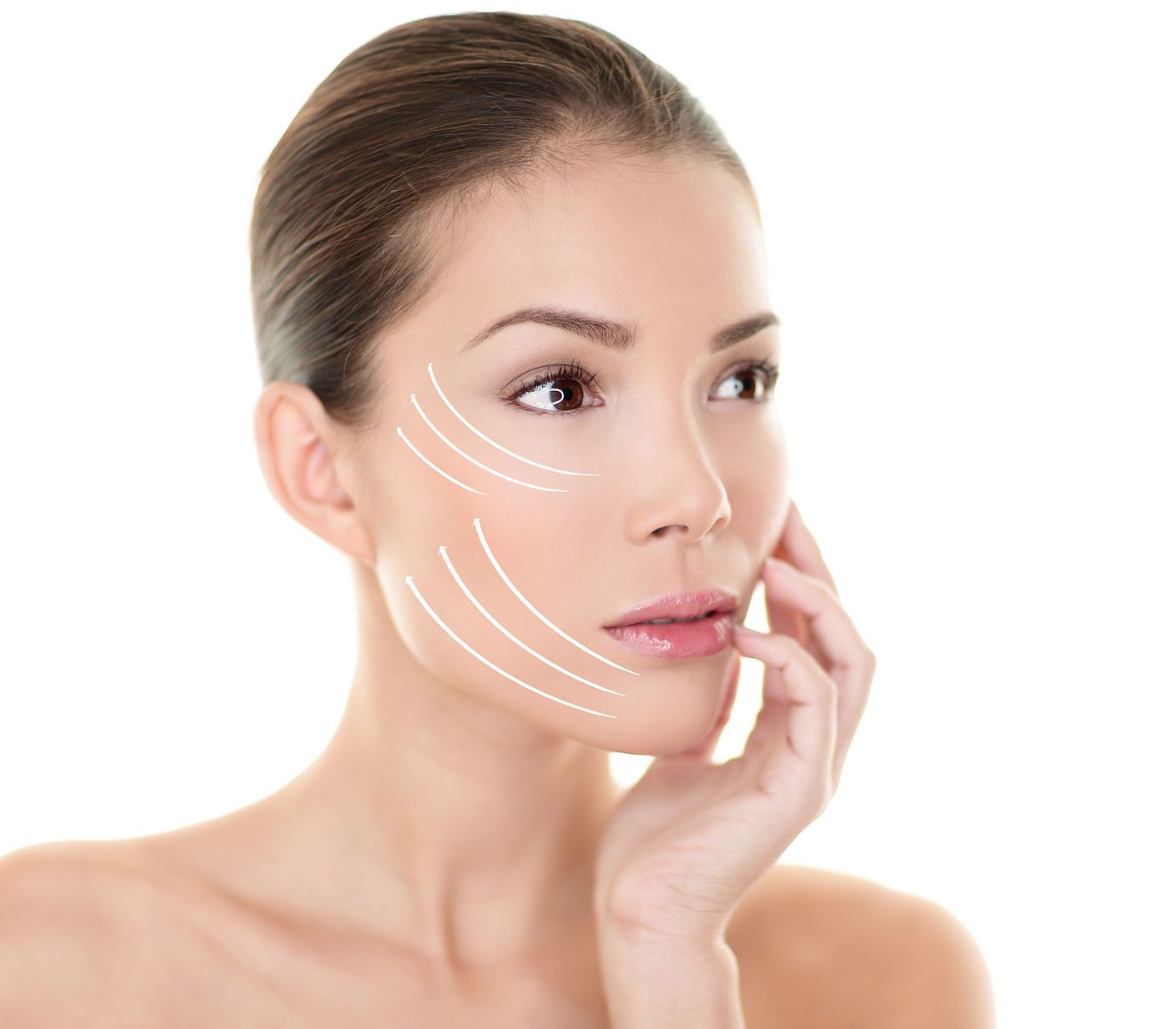 A Woman With Directions On Her Face For Where HIFU Is Done — Aura Mediclinic in Ashmore, QLD