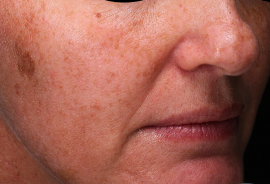 A Close Up Of A Woman's Face Wearing Earrings And A Head Scarf — Aura Mediclinic In Ashmore, QLD