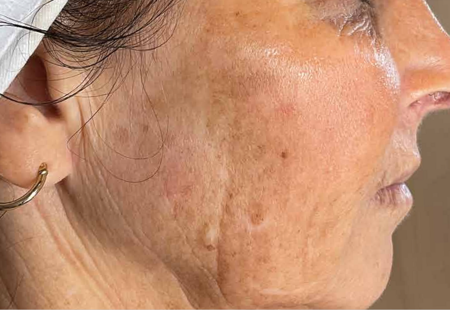 A Close Up Of A Woman's Face Wearing Earrings And A Head Scarf — Aura Mediclinic In Ashmore, QLD