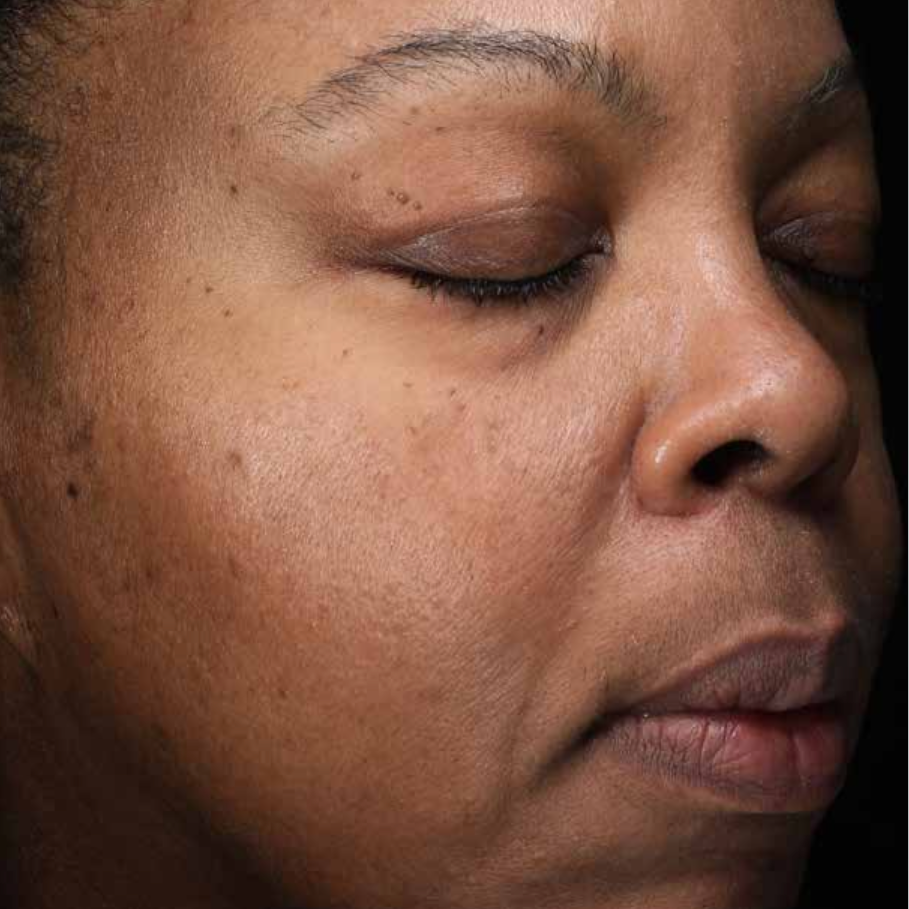 A Close Up Of A Woman's Face Wearing Earrings And A Head Scarf — Aura Mediclinic In Ashmore, QLD