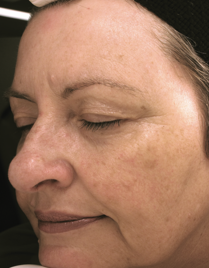 A Close Up Of A Woman's Face Wearing Earrings And A Head Scarf — Aura Mediclinic In Ashmore, QLD