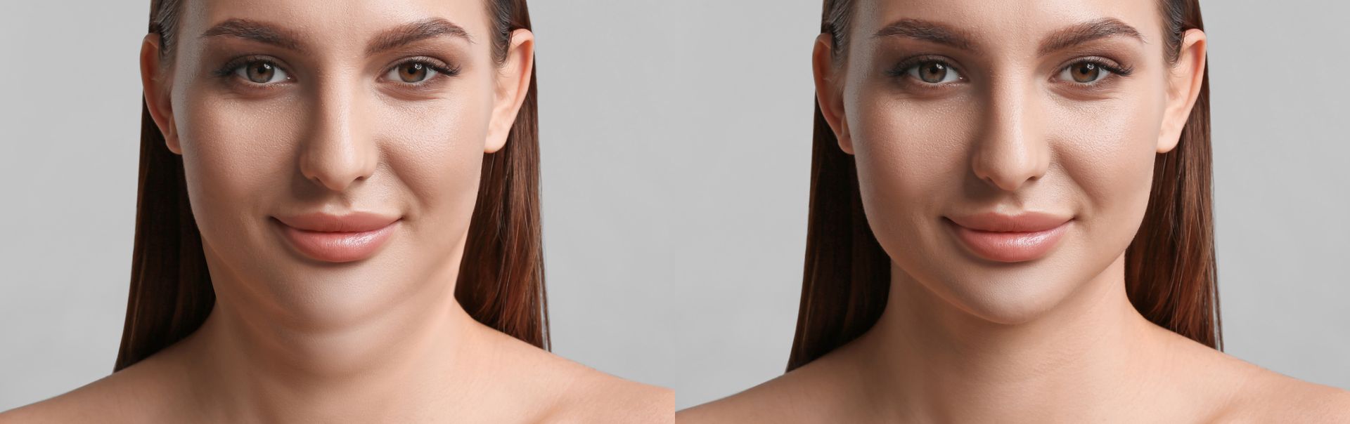 A before and after photo of a woman 's face.