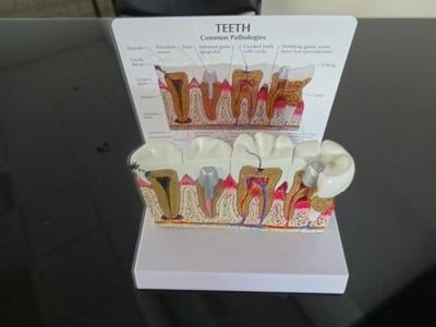 Model Teeth Diagram — Dental Assistant in Bernalillo, NM