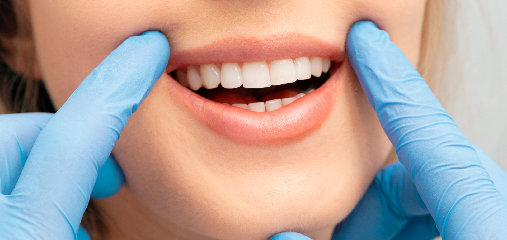 A woman is getting her teeth examined by a dentist.