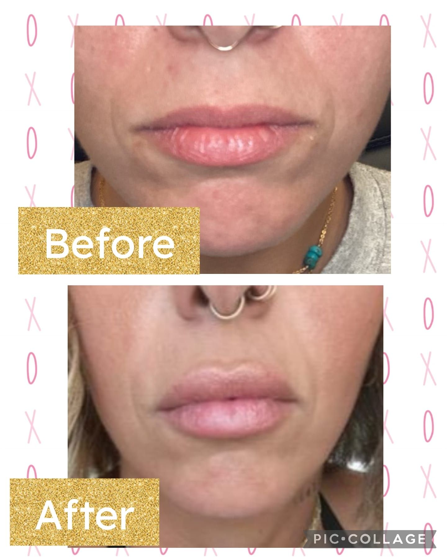 A before and after picture of a woman 's face