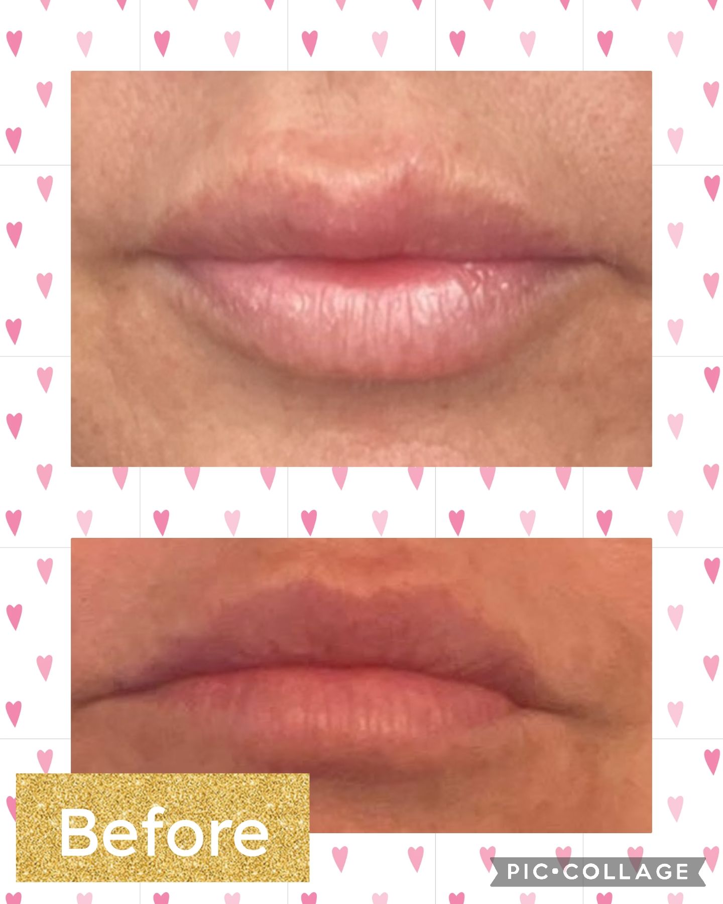 A before and after picture of a woman 's lips with hearts in the background