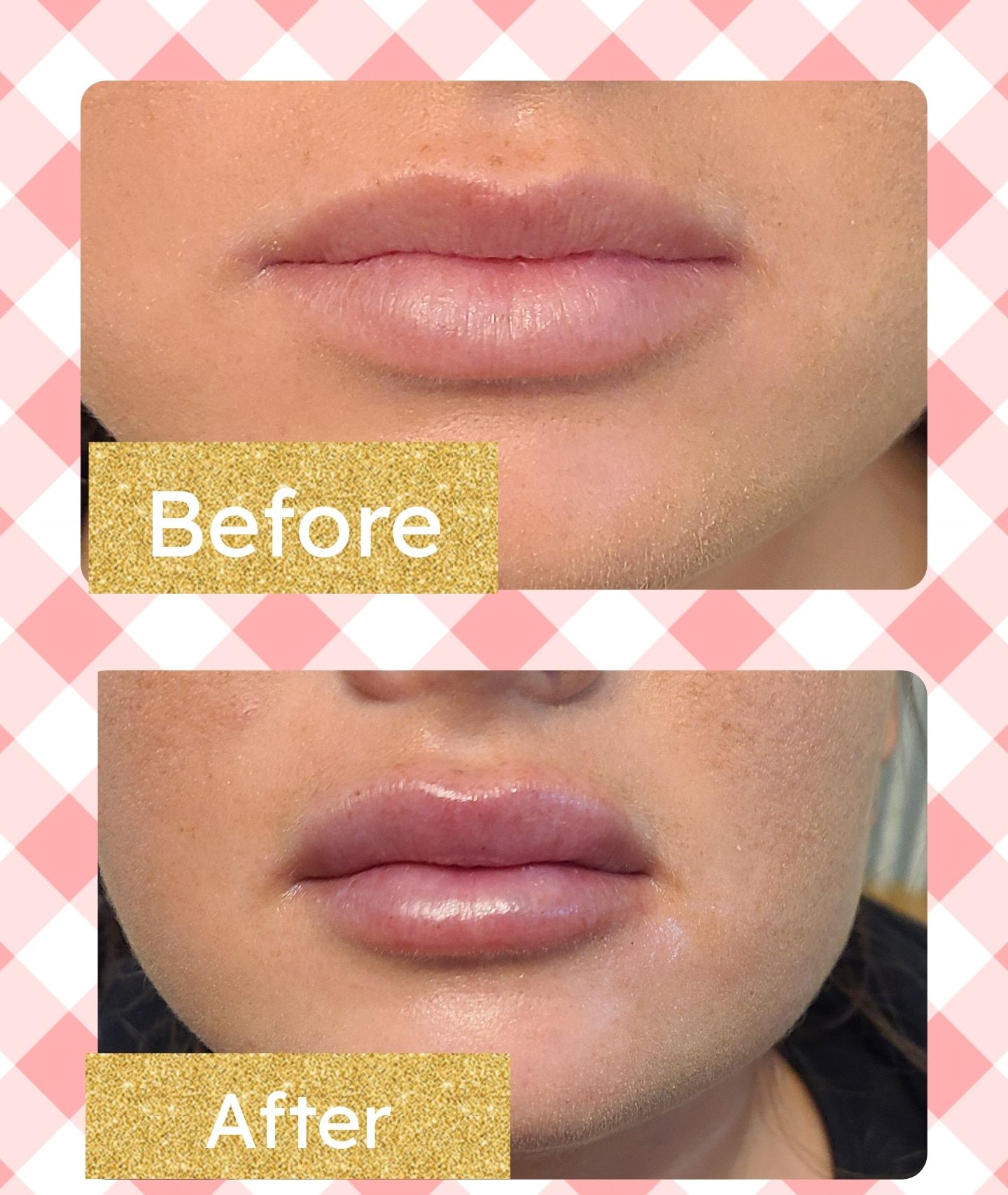 A before and after picture of a woman 's lips with a pink and white checkered background