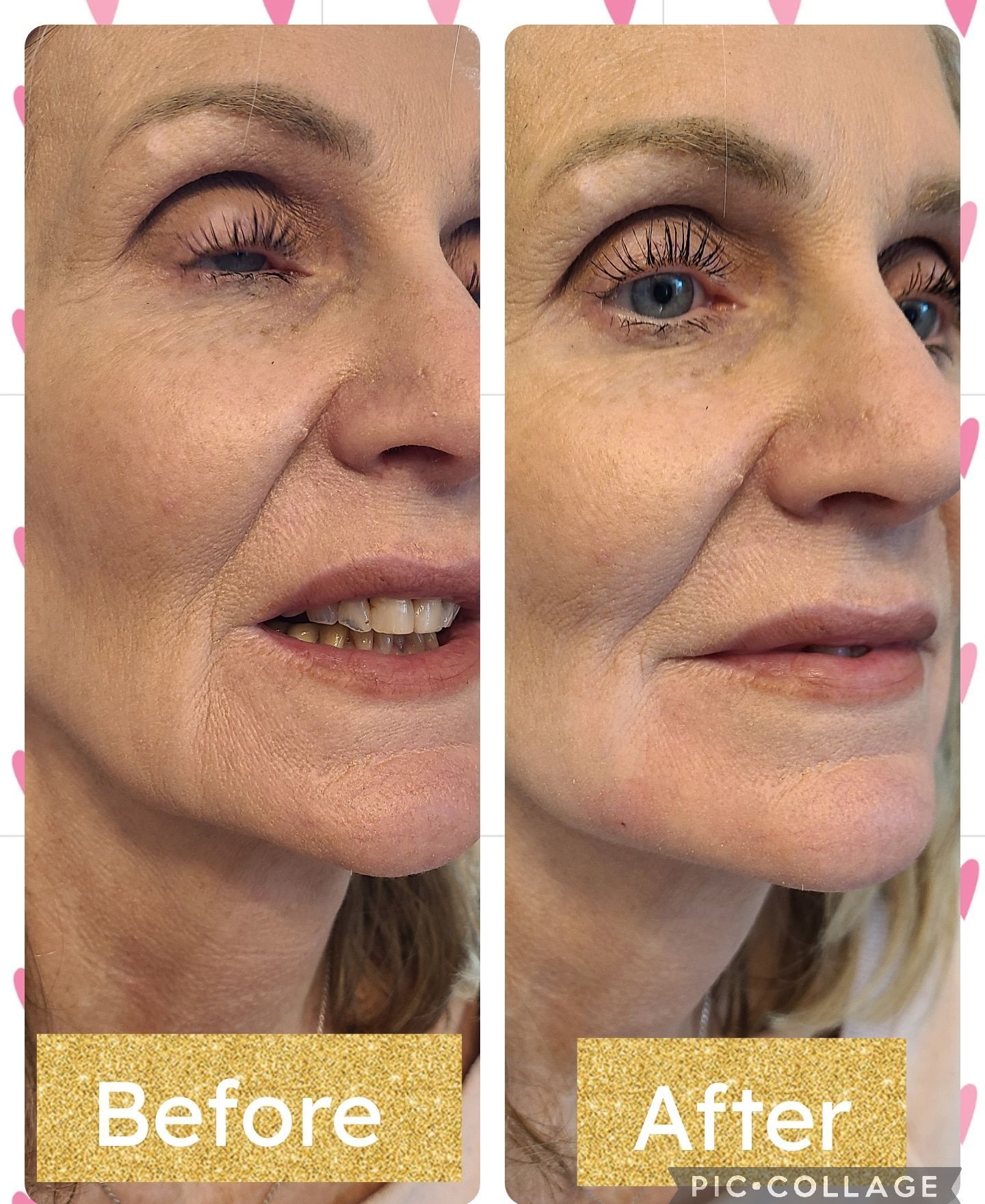 A before and after photo of a woman 's face.