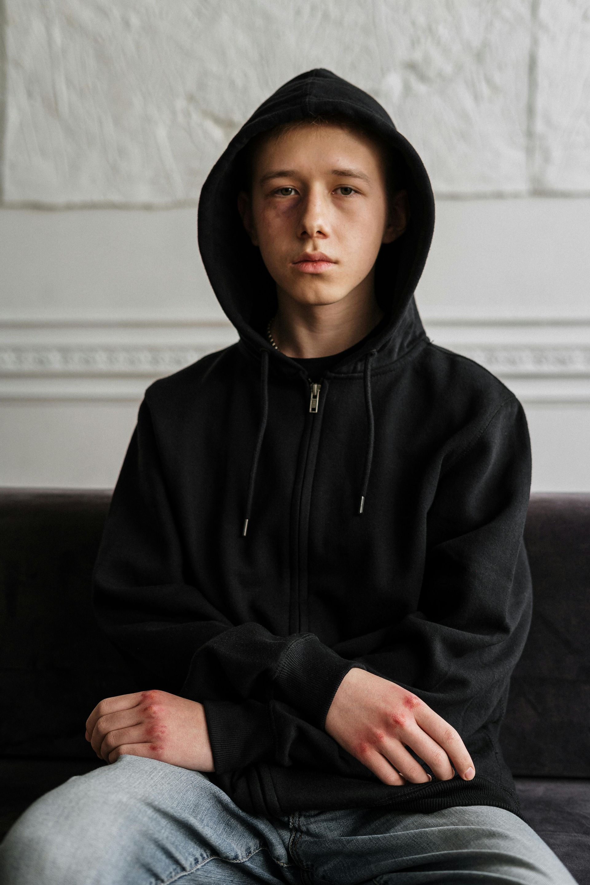 Person in black hoodie with injuries on hands, sitting on a couch.
