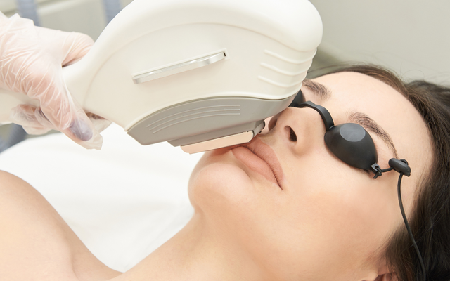 ipl melanotan IPL Photofacial | Nexa Med Spa