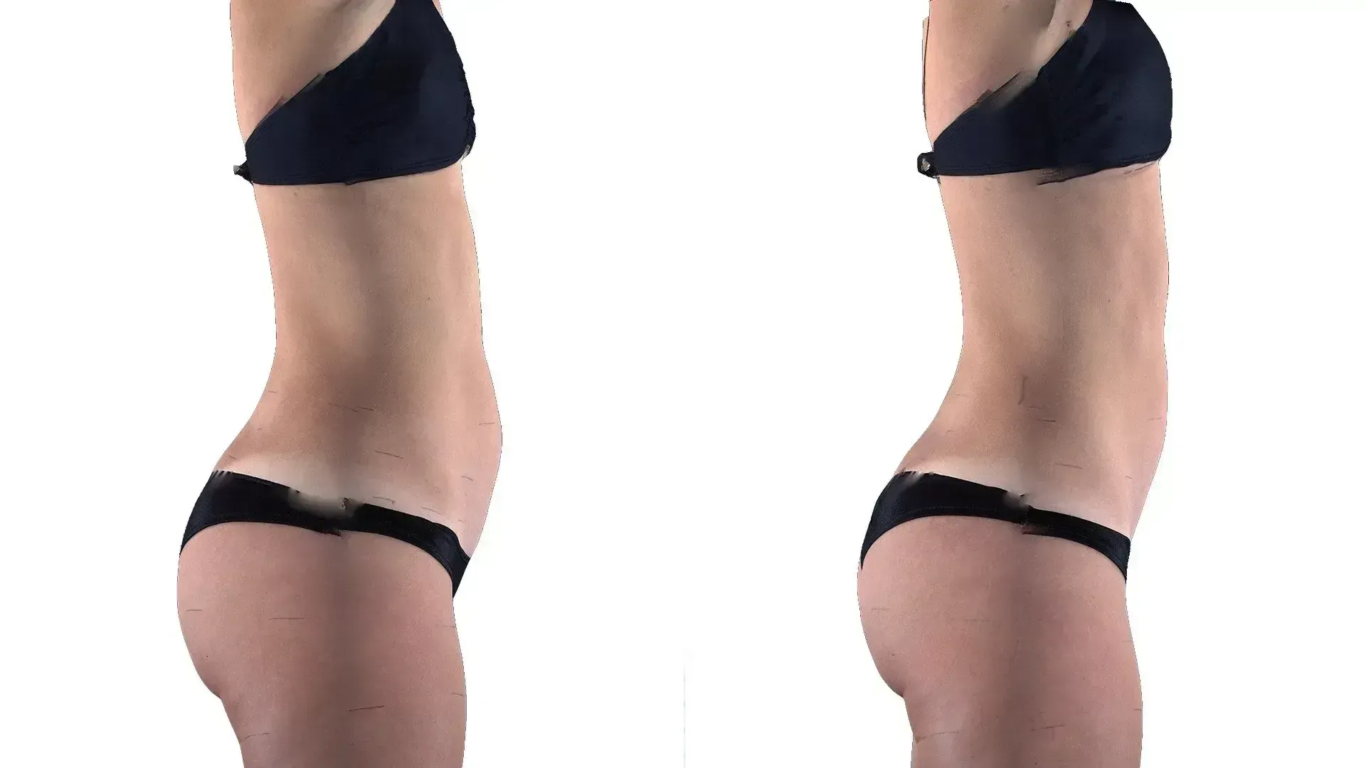 Two side-profile views of a person in black lingerie; the right shows a more pronounced buttock shape.