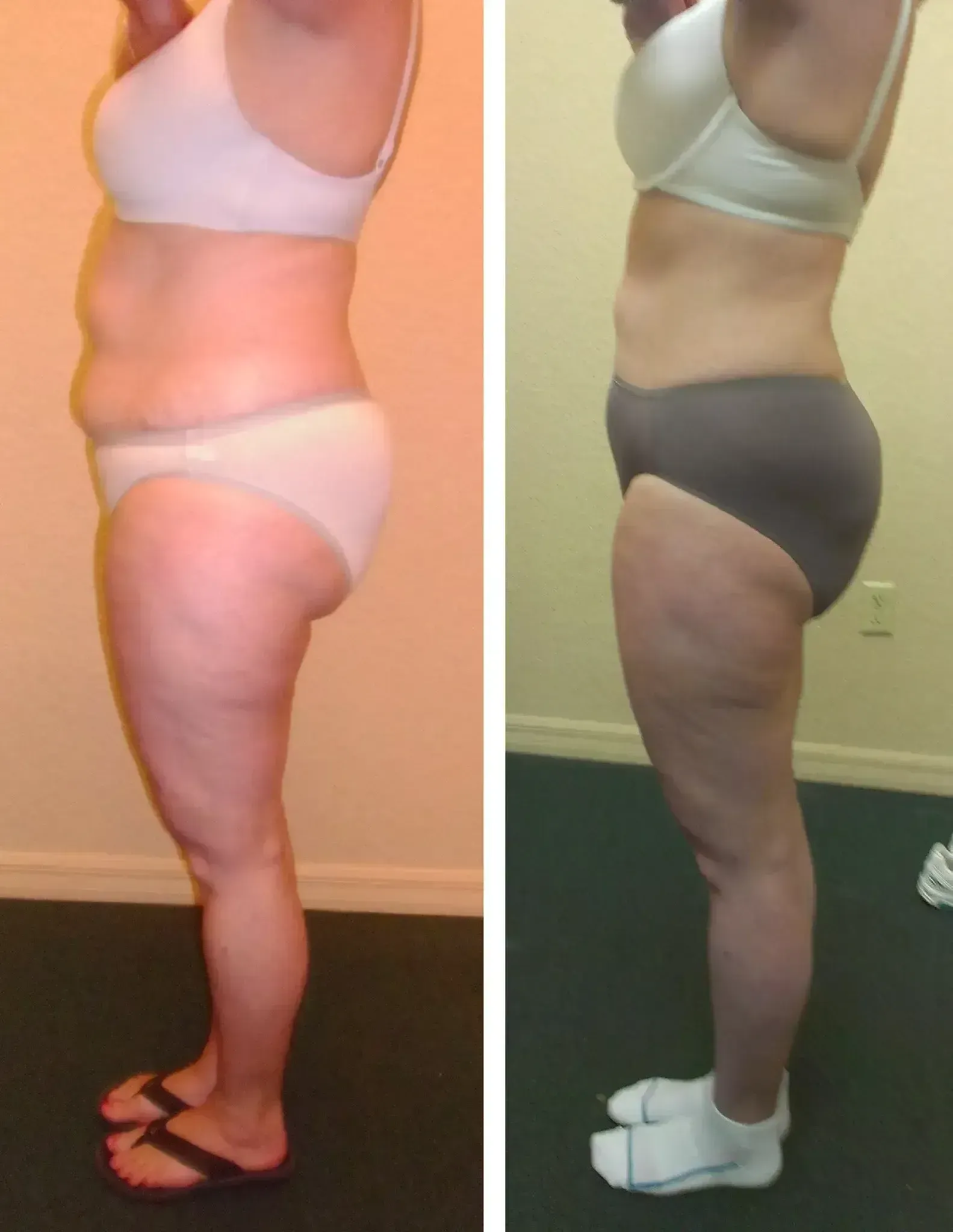 Before and after photos of a person. Left: tan skin, light undergarments, sandals. Right: gray undergarments, white socks.