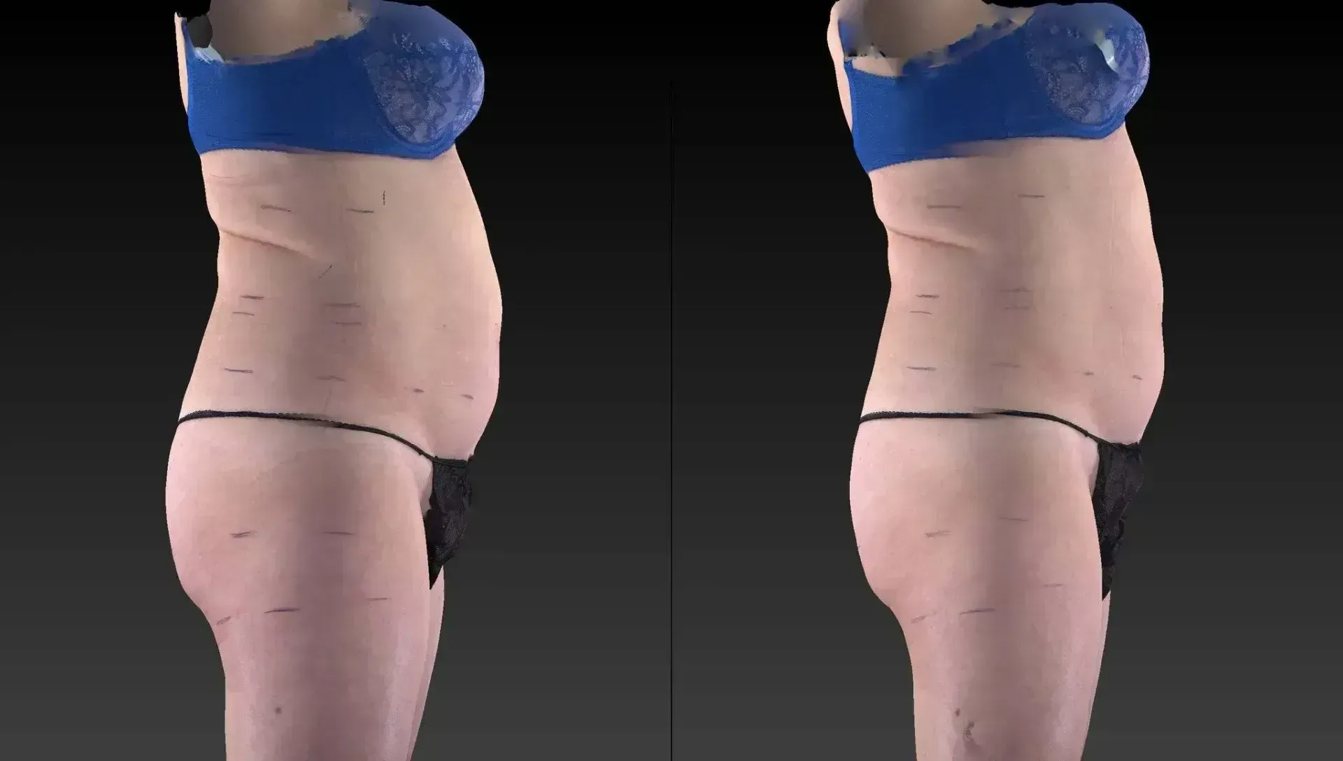 Two side-view body scans; before and after, showing a reduction in abdominal fat. Person in blue bra and black underwear.