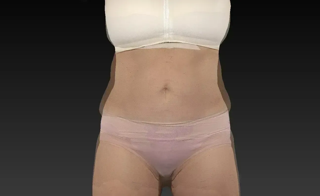 Person's torso in bra and underwear, centered against a dark background.