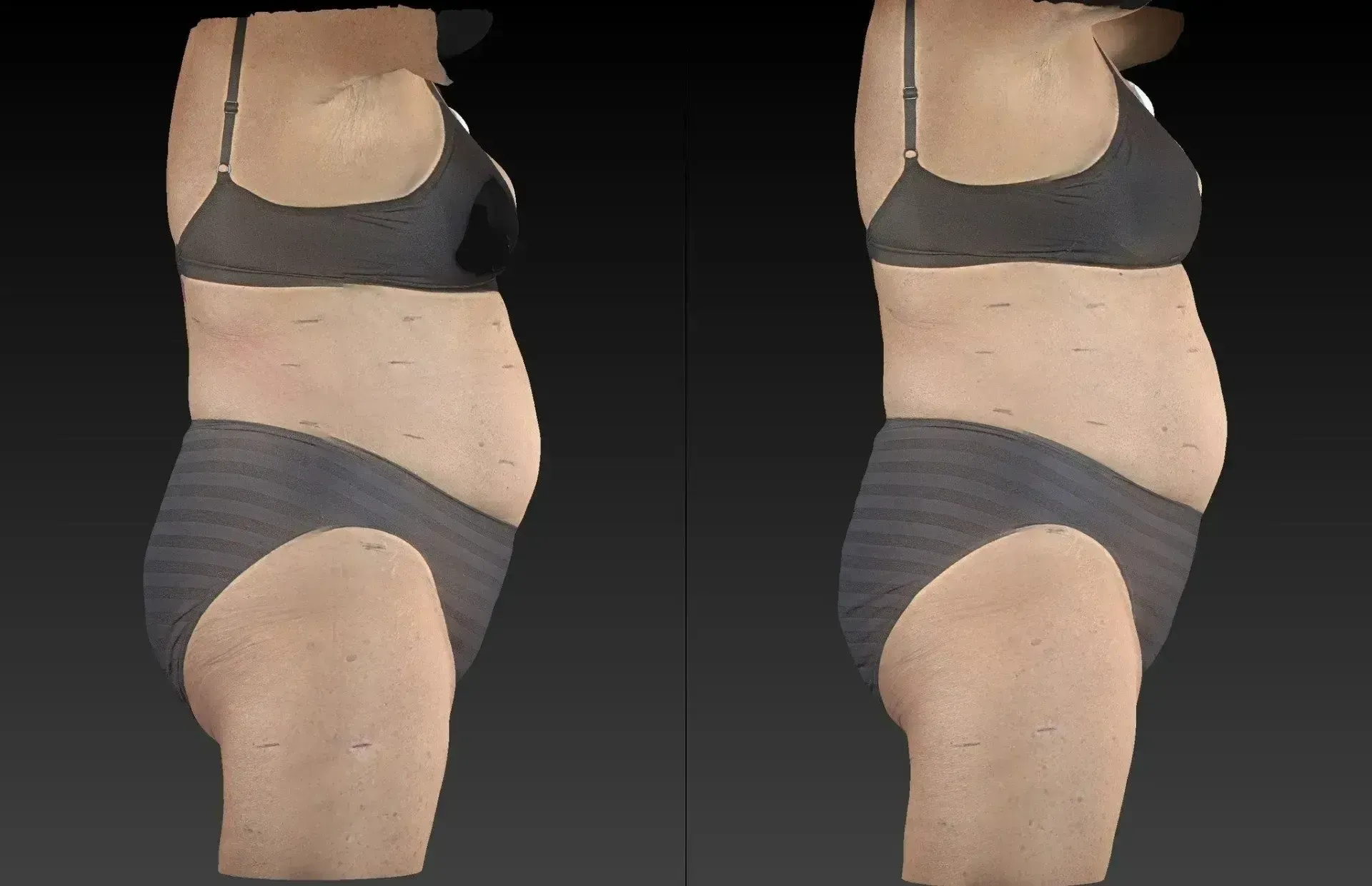 Two side-view body scans; left with a flatter stomach, right with a more protruding stomach, both in underwear.