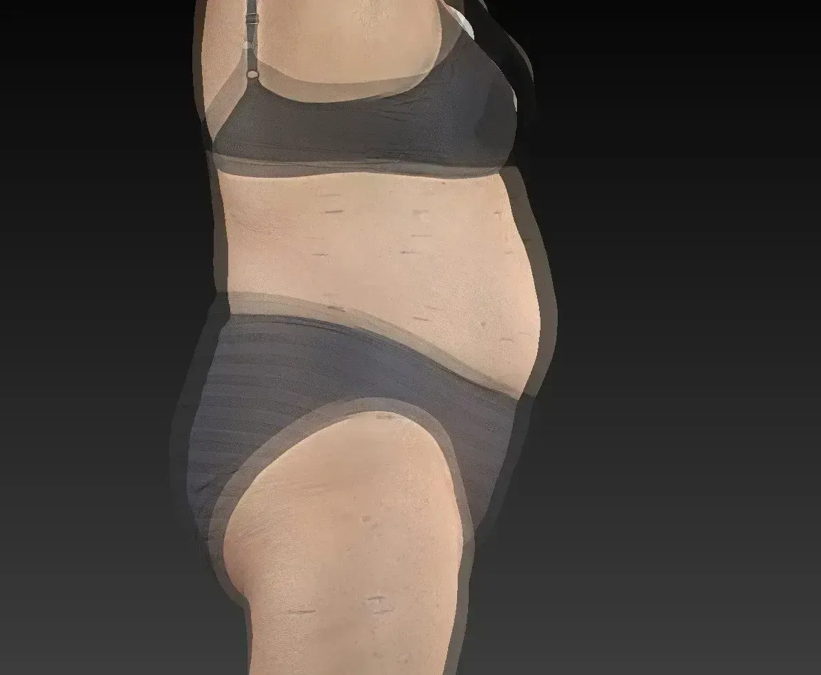 Side profile of a person in underwear, showing a protruding abdomen and blurred, speckled textures against a dark background.