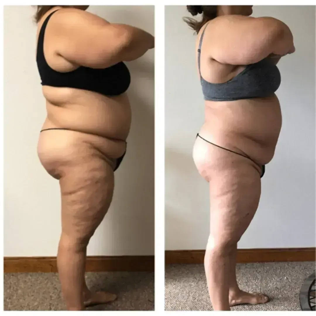 Two side-view photos of a person. Before and after weight loss results, showing less body fat.