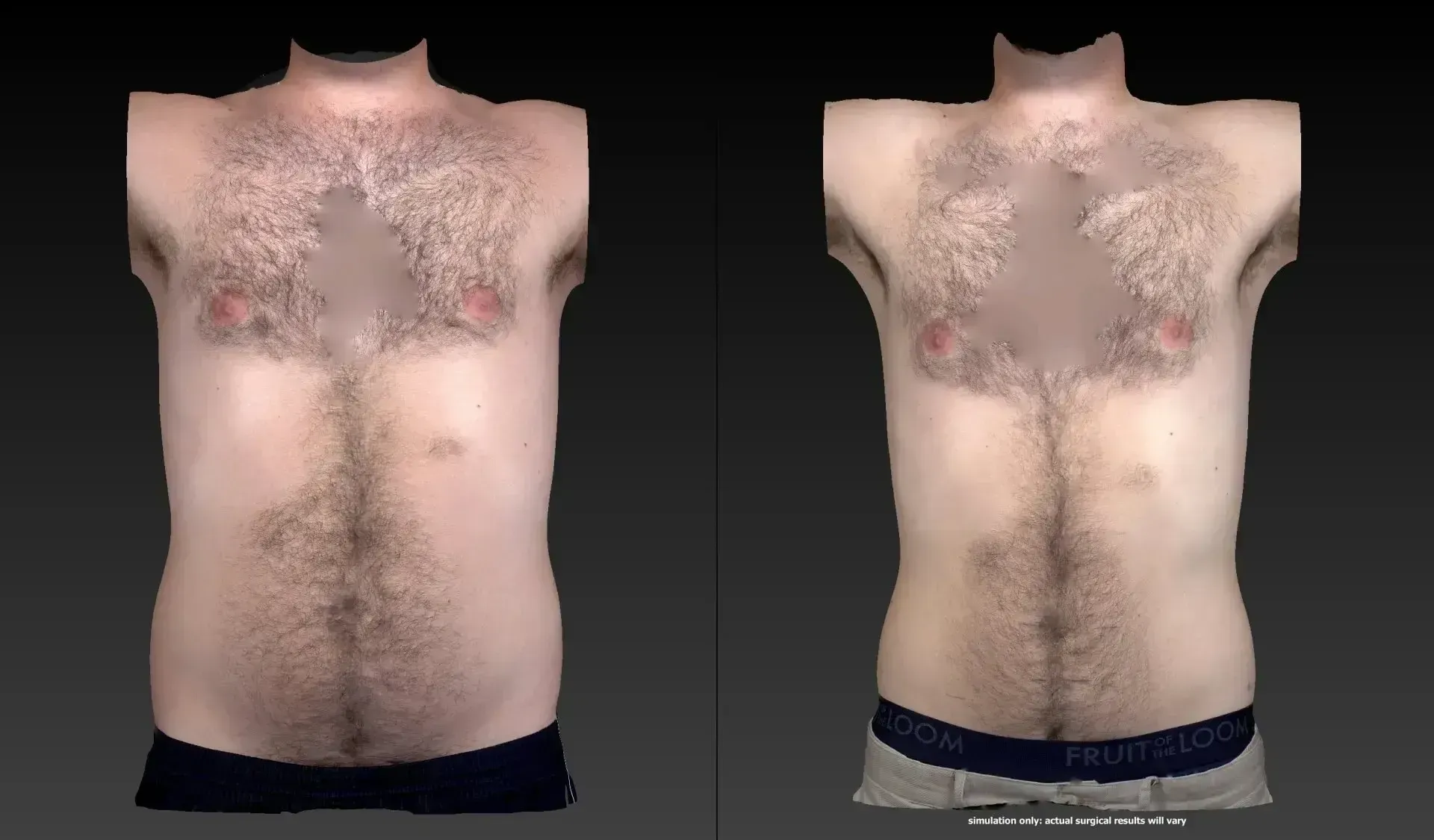 Two male torsos with varying amounts of chest and abdominal hair; wearing dark and light colored underwear.