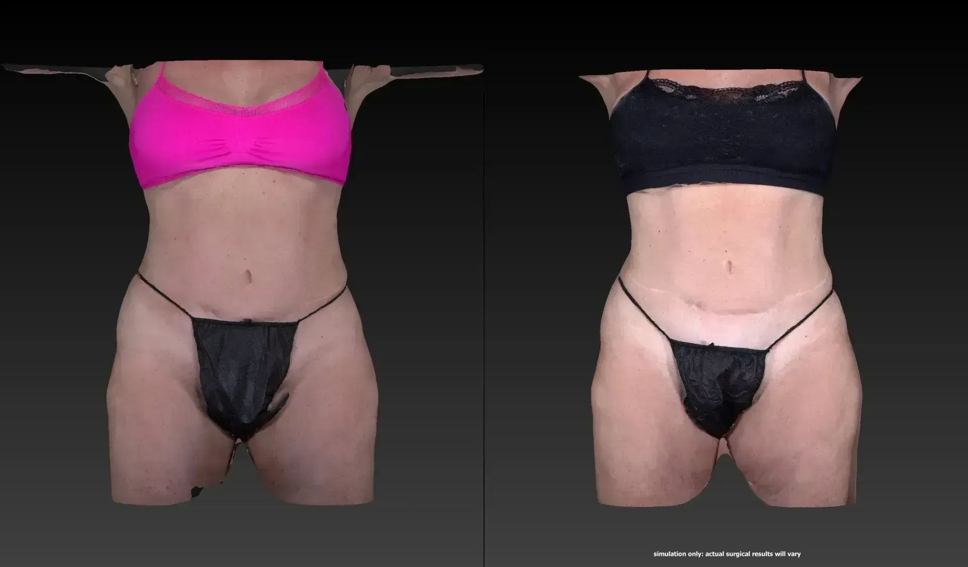 Two torsos, one in a pink top, the other in black, both with black underwear. Dark background.