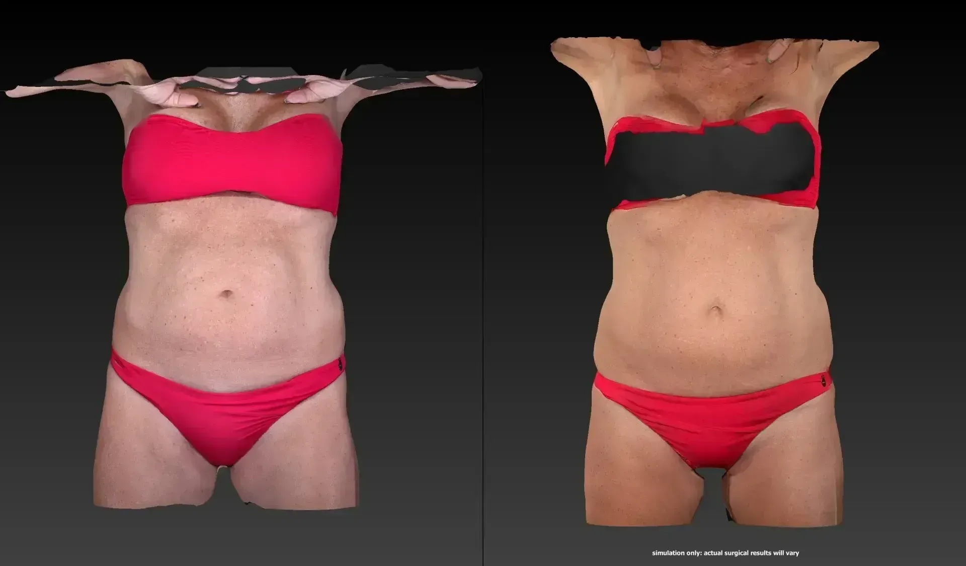 Two torsos in red bikinis, one with a red top, the other with a black top.