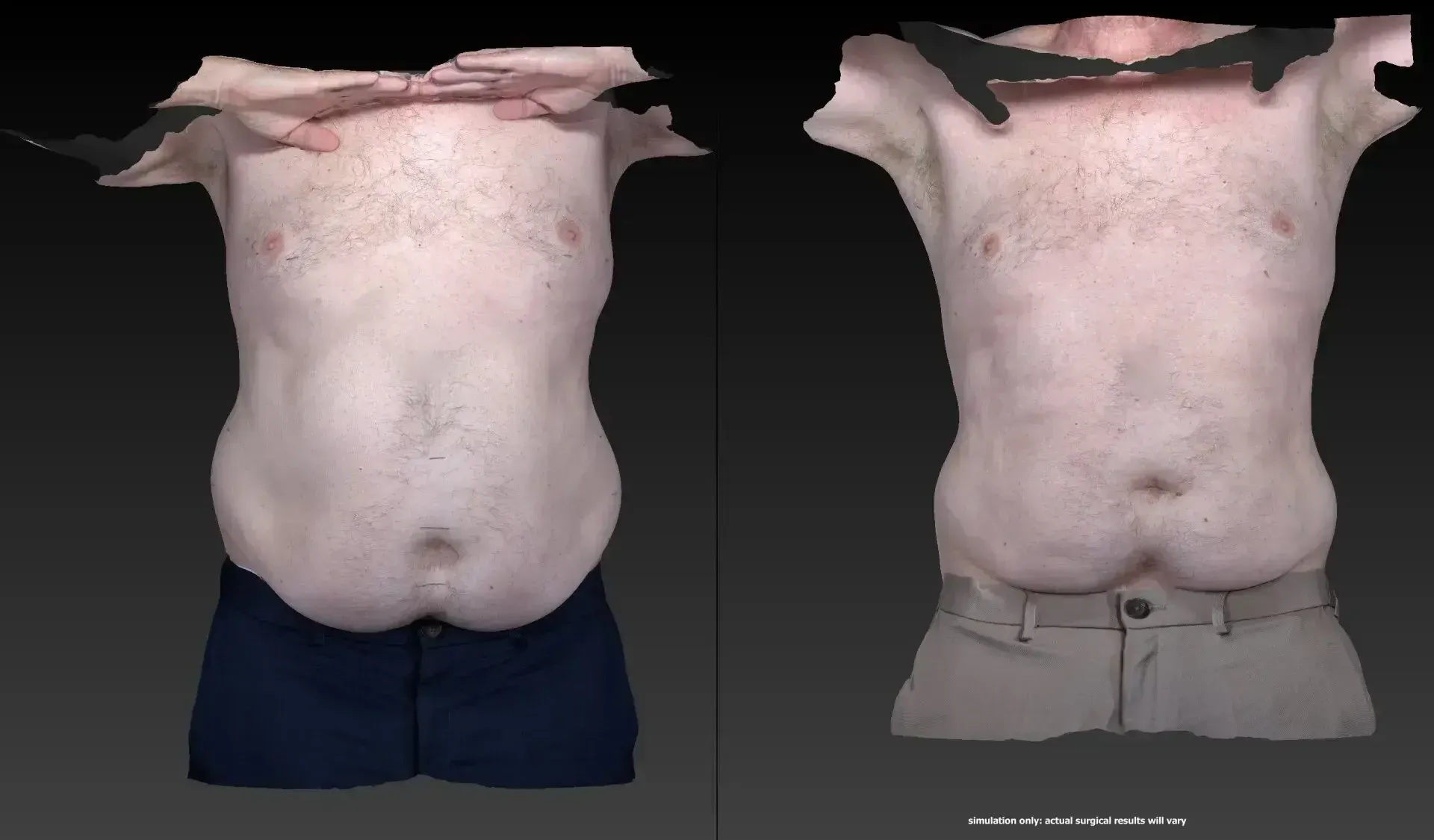 Two torsos side-by-side, one in blue shorts, one in khaki pants. Shows weight difference in body shape.