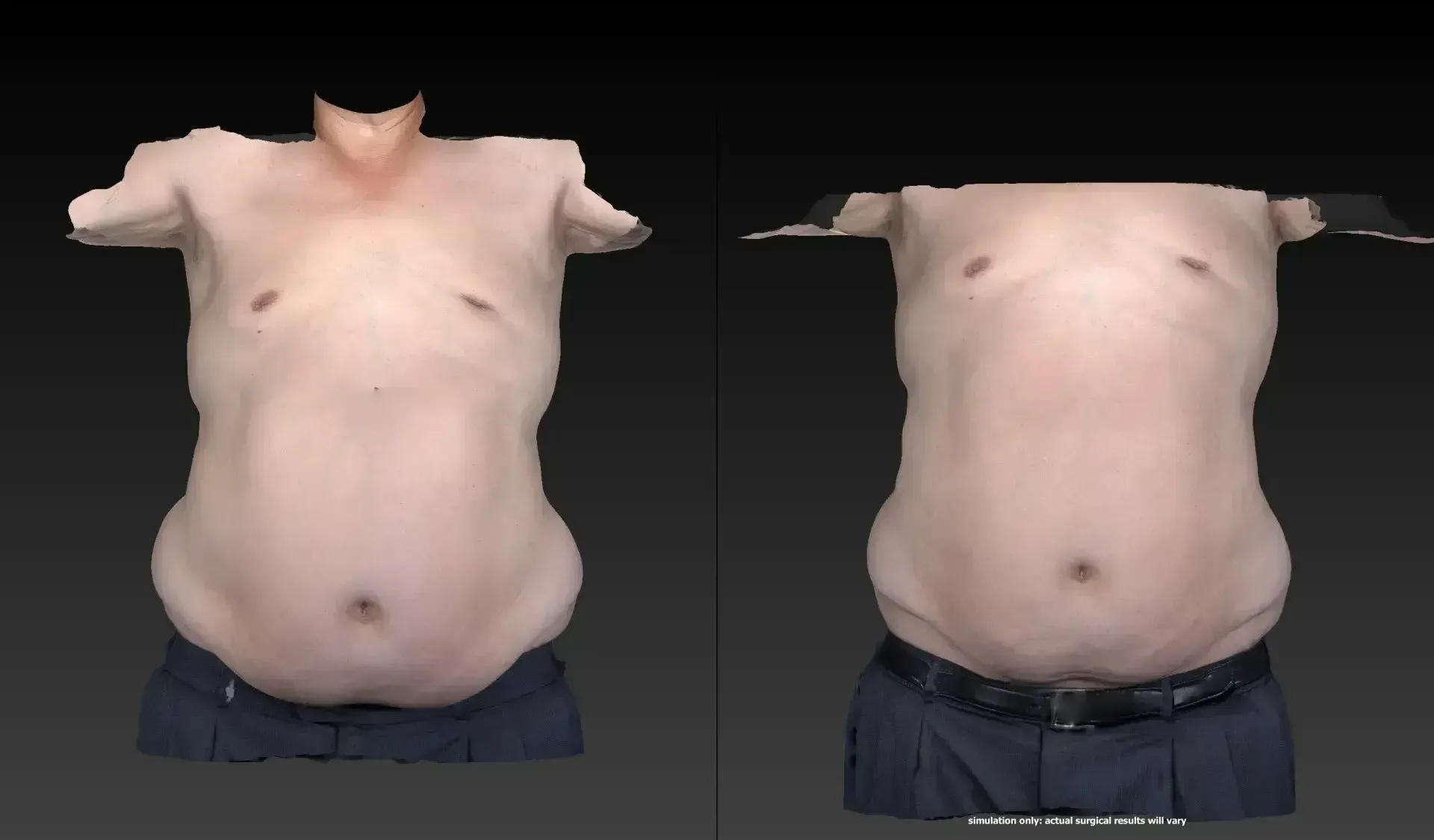 Two torsos with visible belly fat, wearing dark pants, shown against a dark gray background.