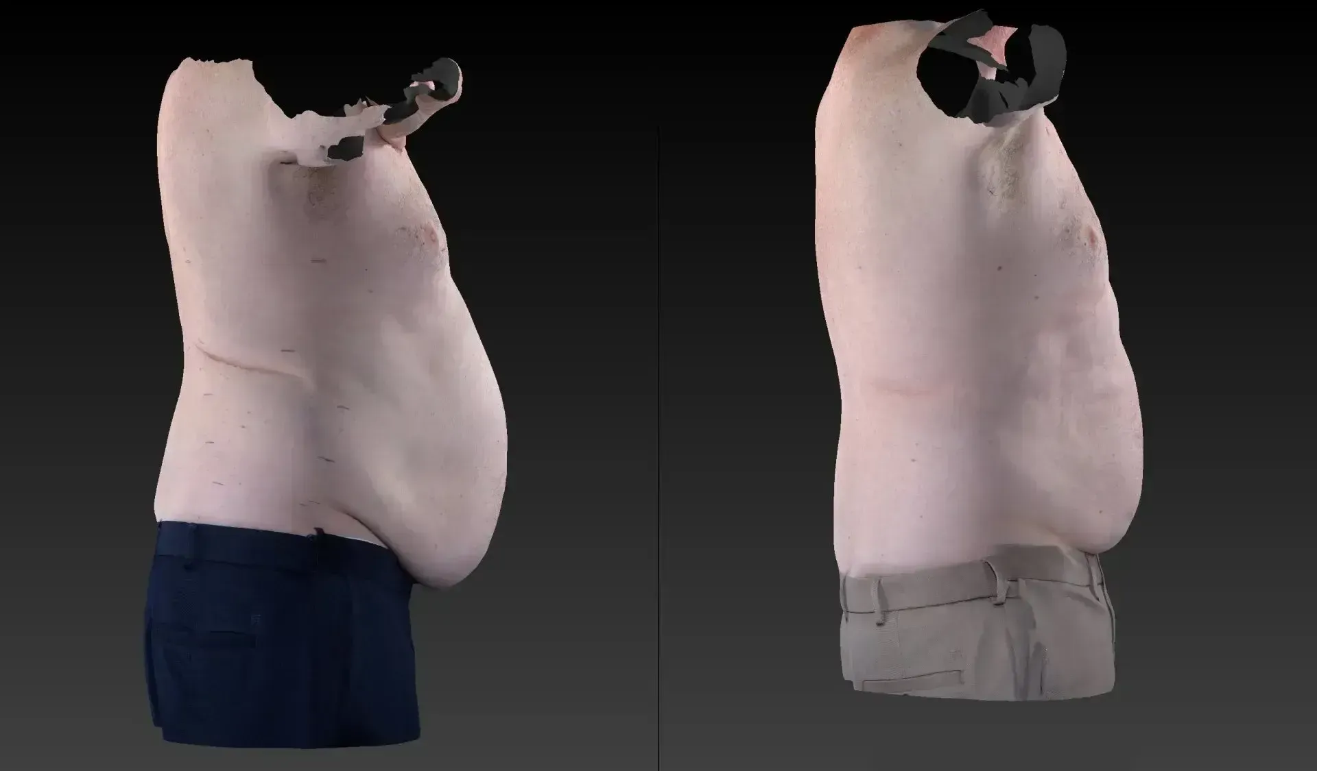 3D scans of a person's torso from two angles, showing belly, dark pants on left, gray pants on right.
