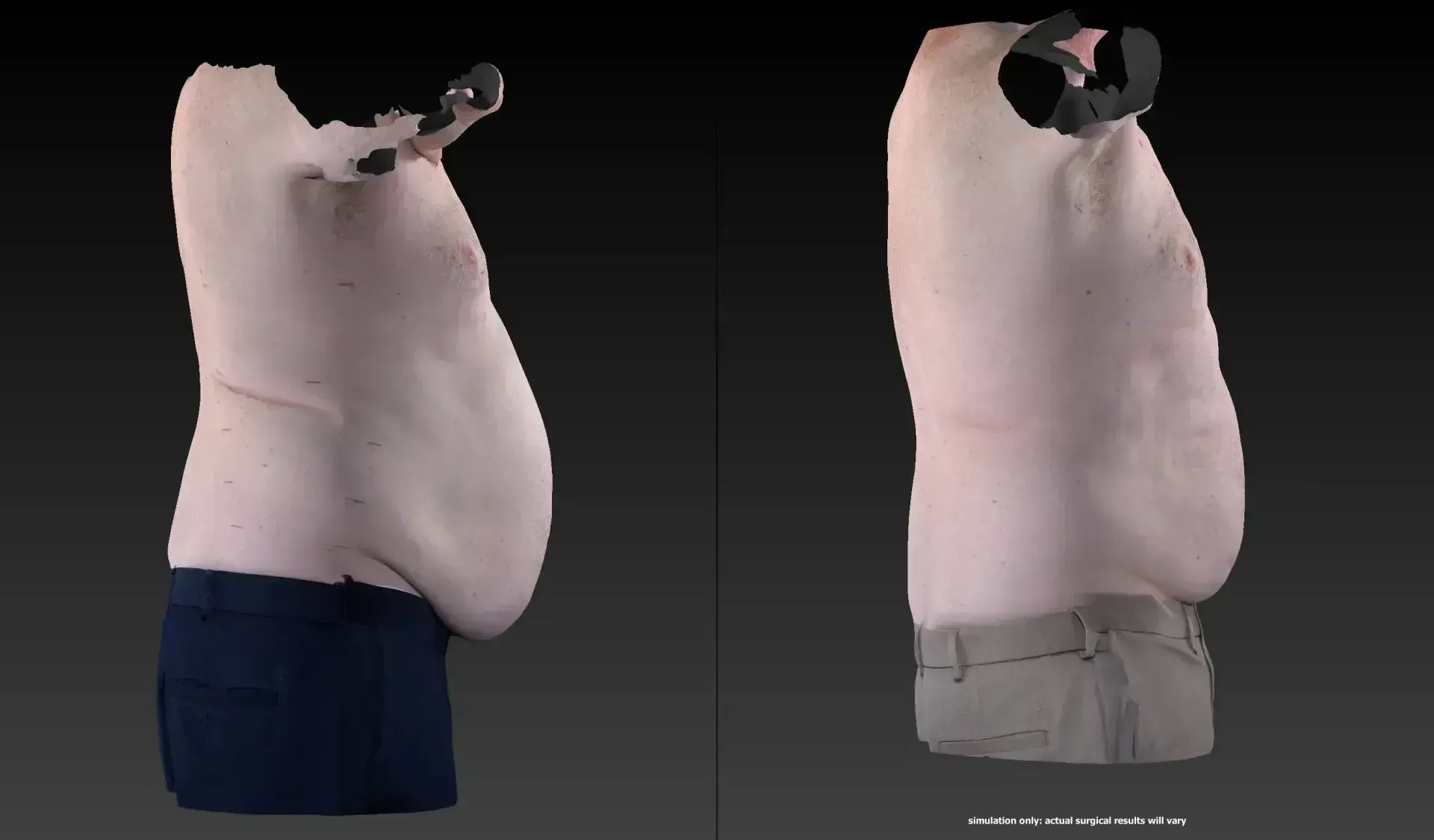 Two 3D scans of a person's torso: side views, one with blue pants, the other with gray pants.