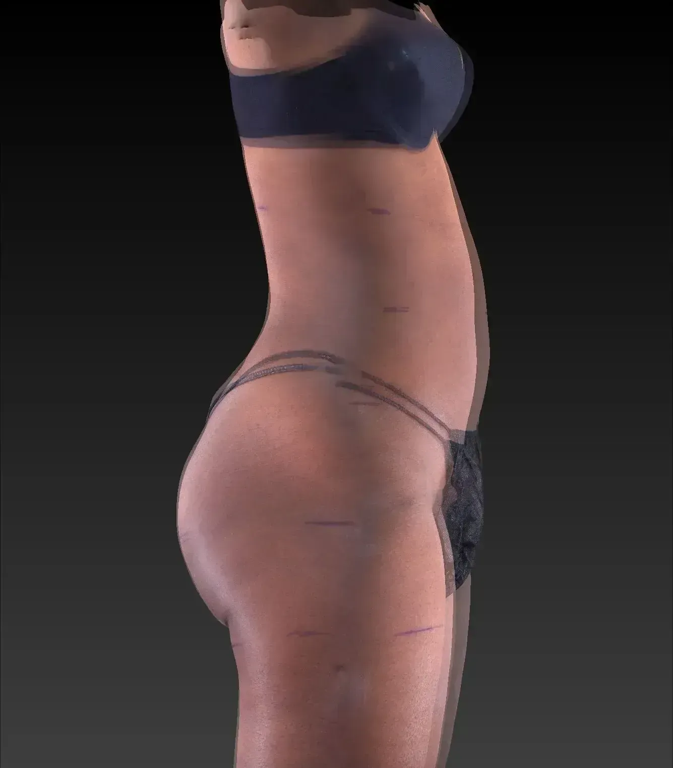Side view of a person in lingerie with markings on their skin.