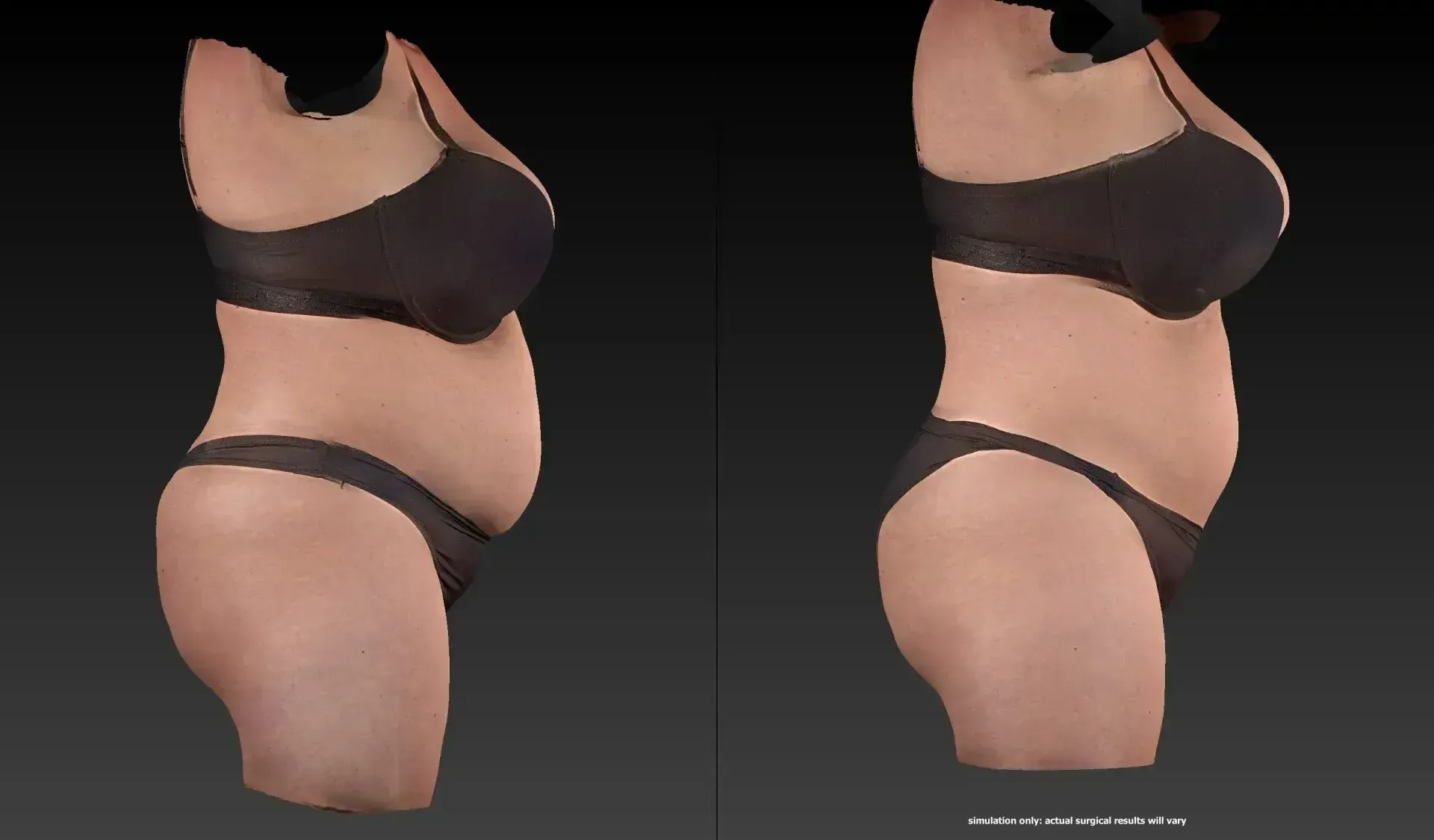 Two side-view renderings of a body in black lingerie, one with a larger abdomen.