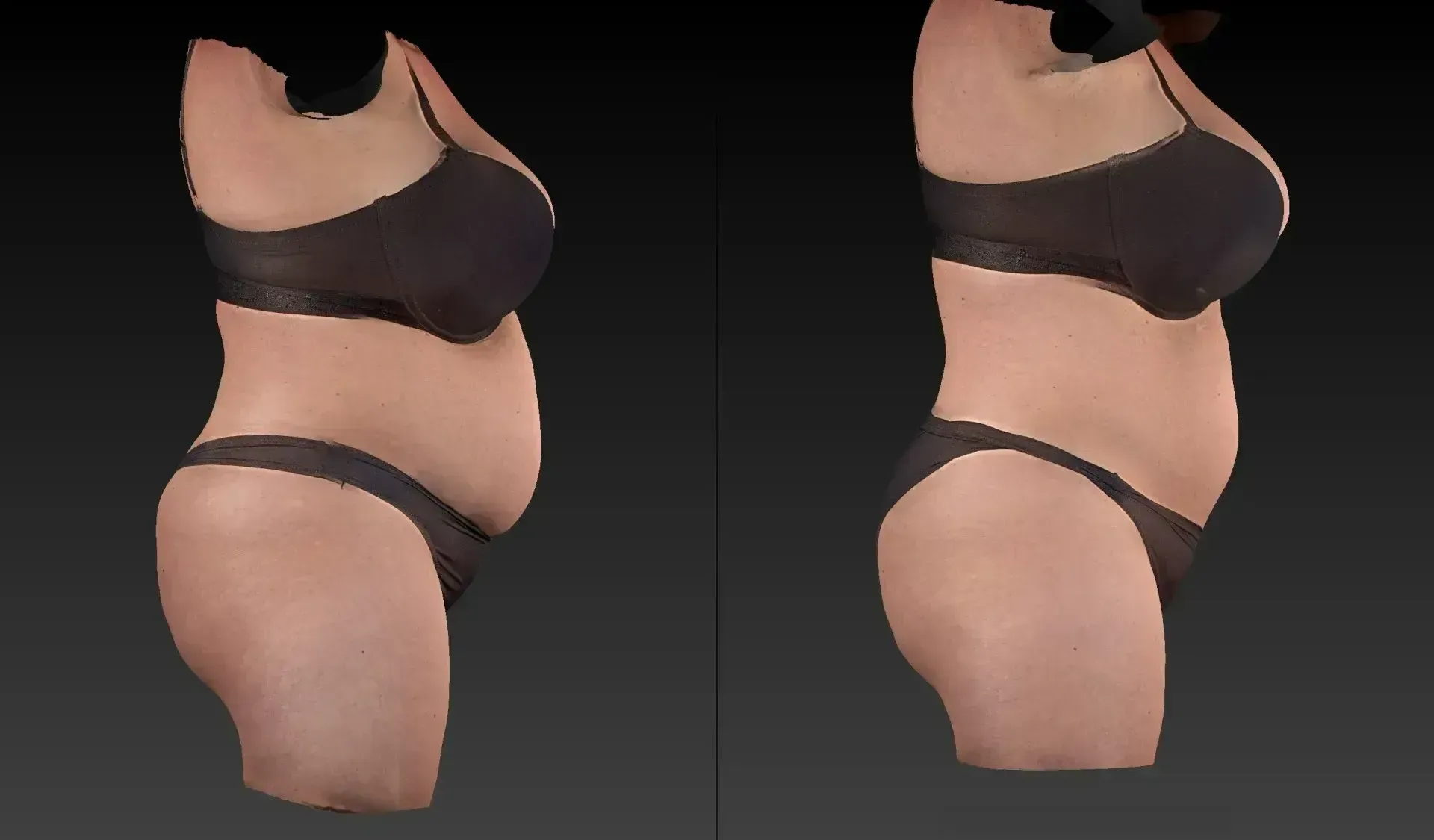 Two side-view figures in black lingerie, showing abdomen and torso contours.