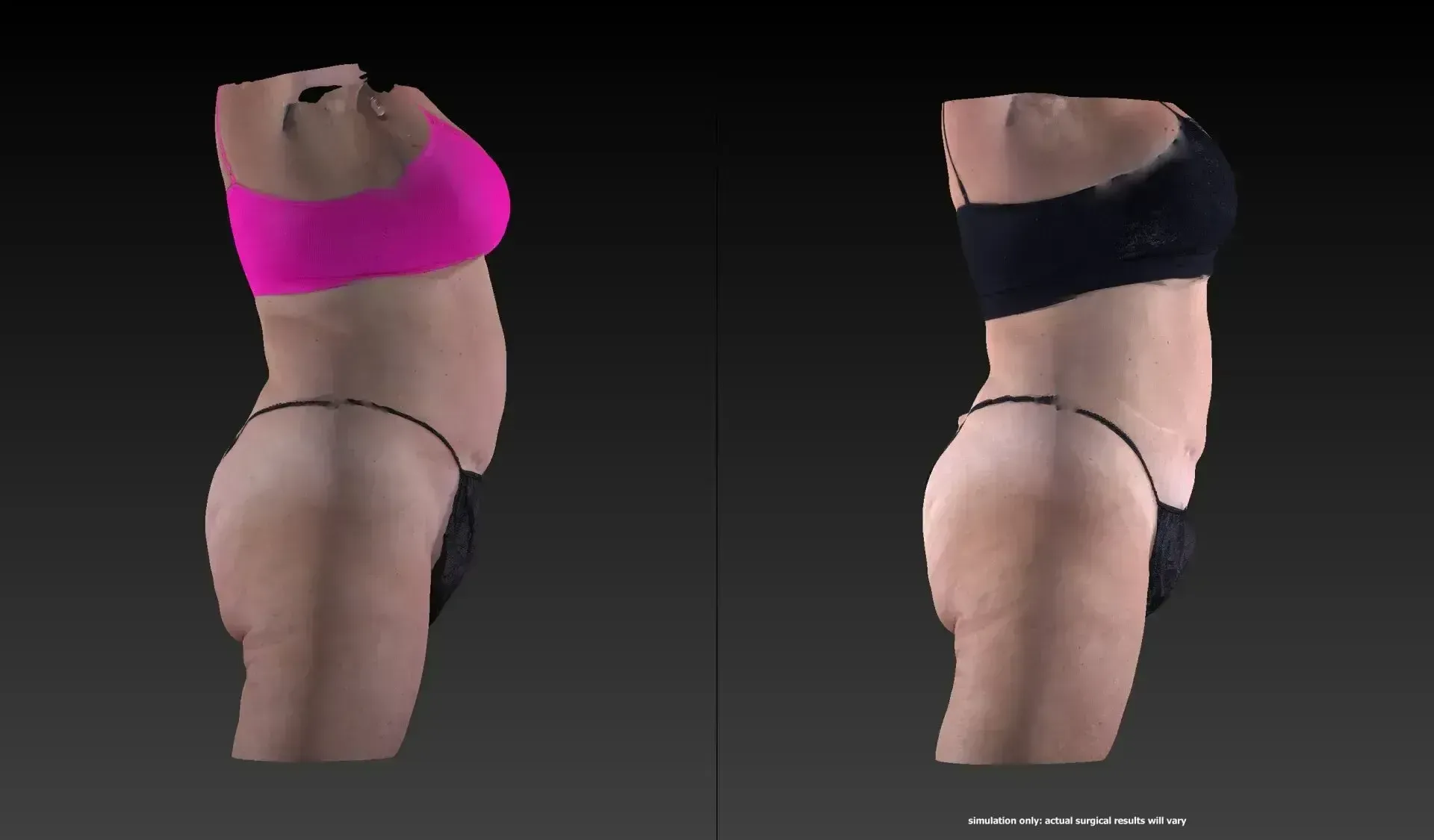 Side-by-side comparison of a person's torso in a pink and black top and bottom, before and after a body change.