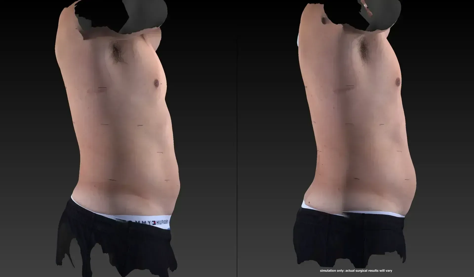 Two side-profile views of a torso wearing dark underwear, showing a slight posture difference.