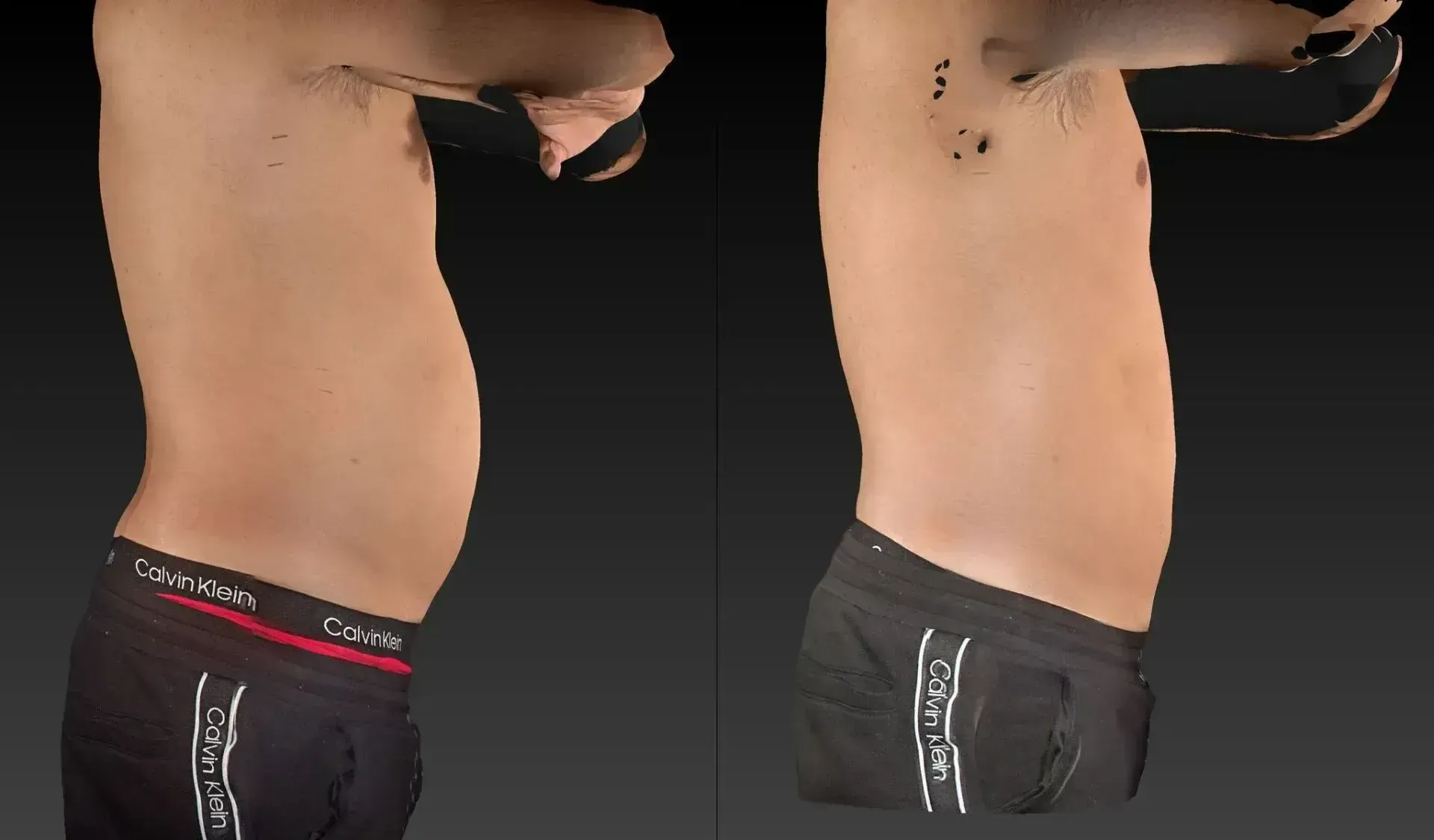 Two side-by-side torso views. The left has a slightly larger abdomen. Both wear black shorts.